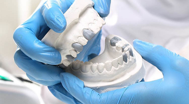 prótese dentária no rj-SB-Ortoimplante -Clinica-Odontologica-dentista-no-Rio-de-janeiro-aparelho-fixo-750x414